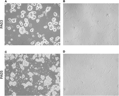 Pituispheres Contain Genetic Variants Characteristic to Pituitary Adenoma Tumor Tissue